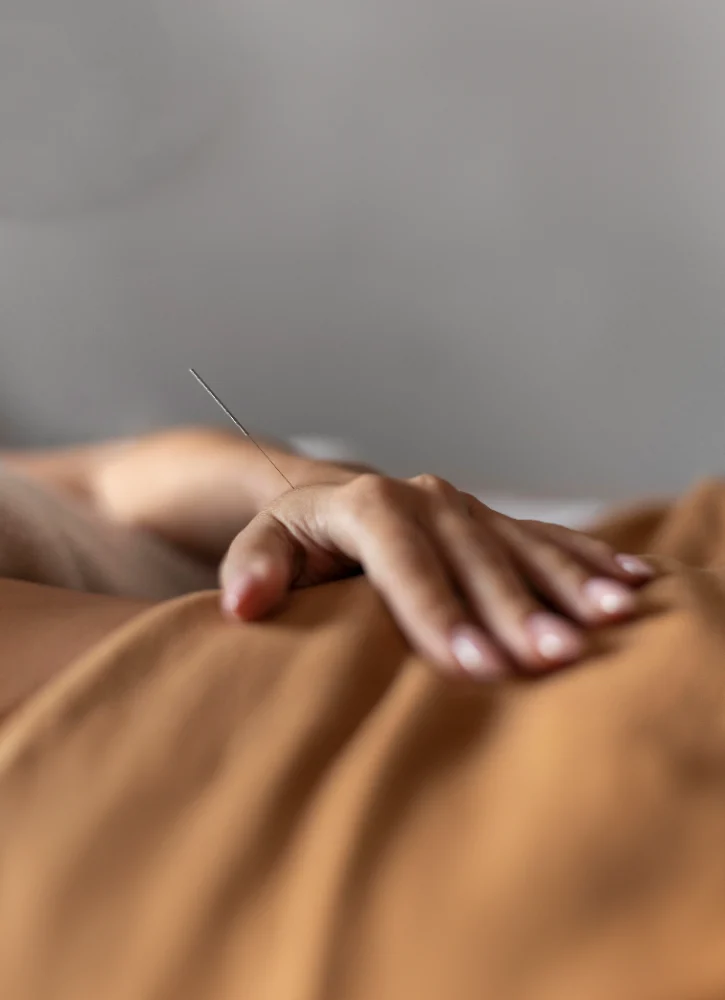 טיפול דיקור סיני